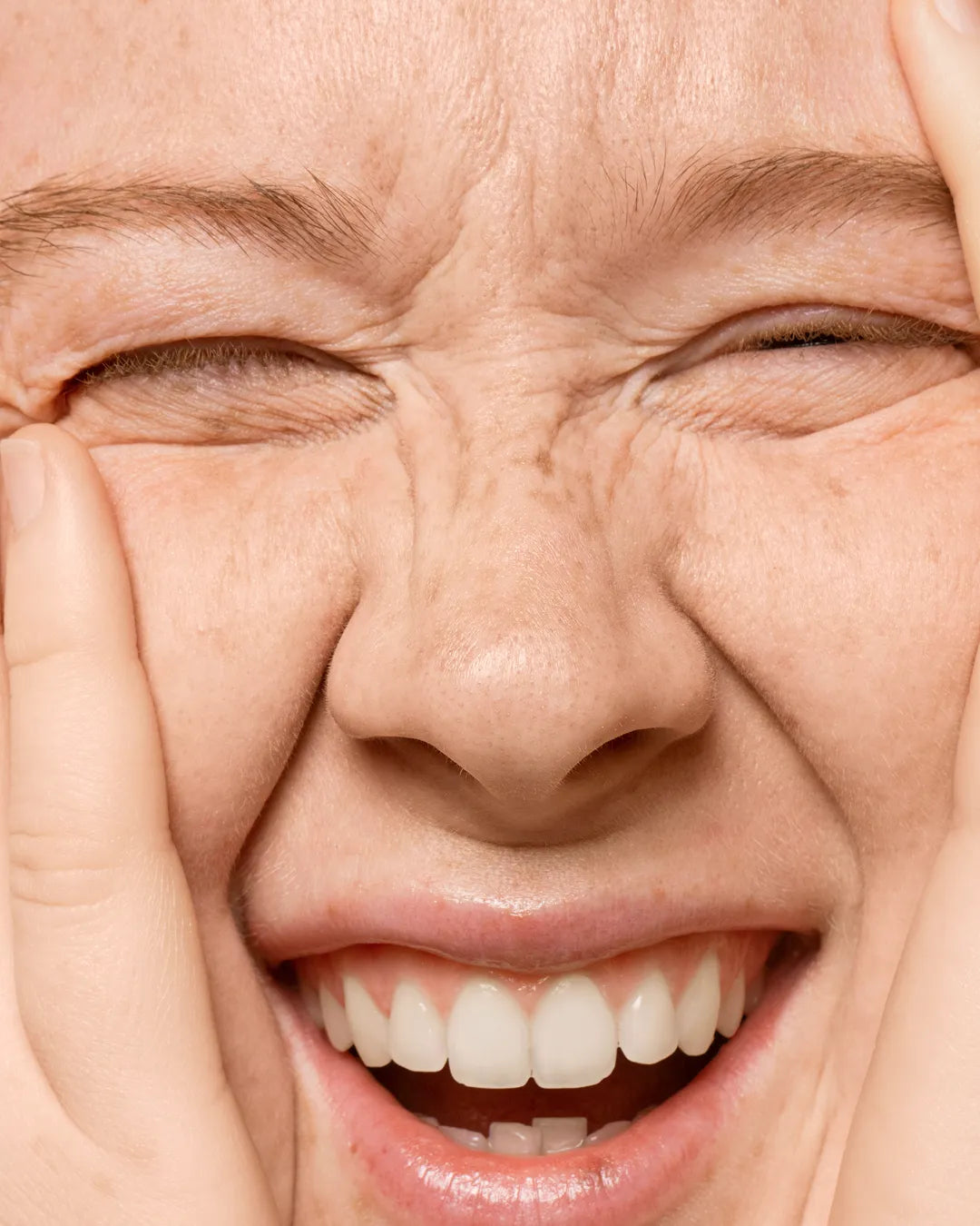 Arrugas de expresión Baby