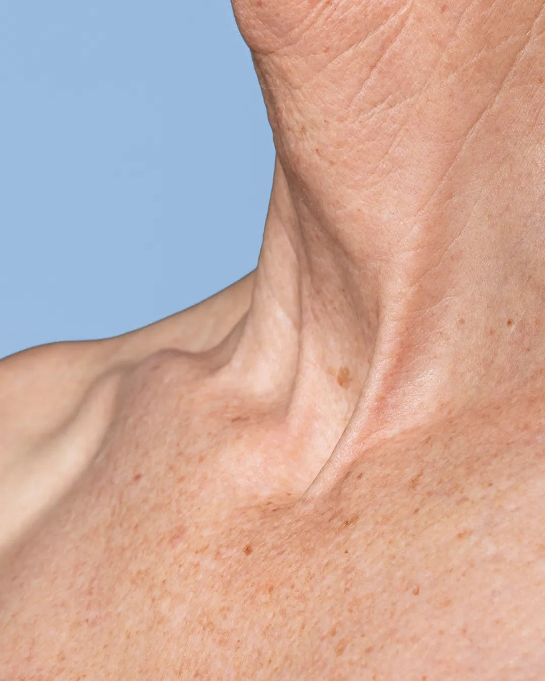 Rejuvenecimiento del cuello y escote