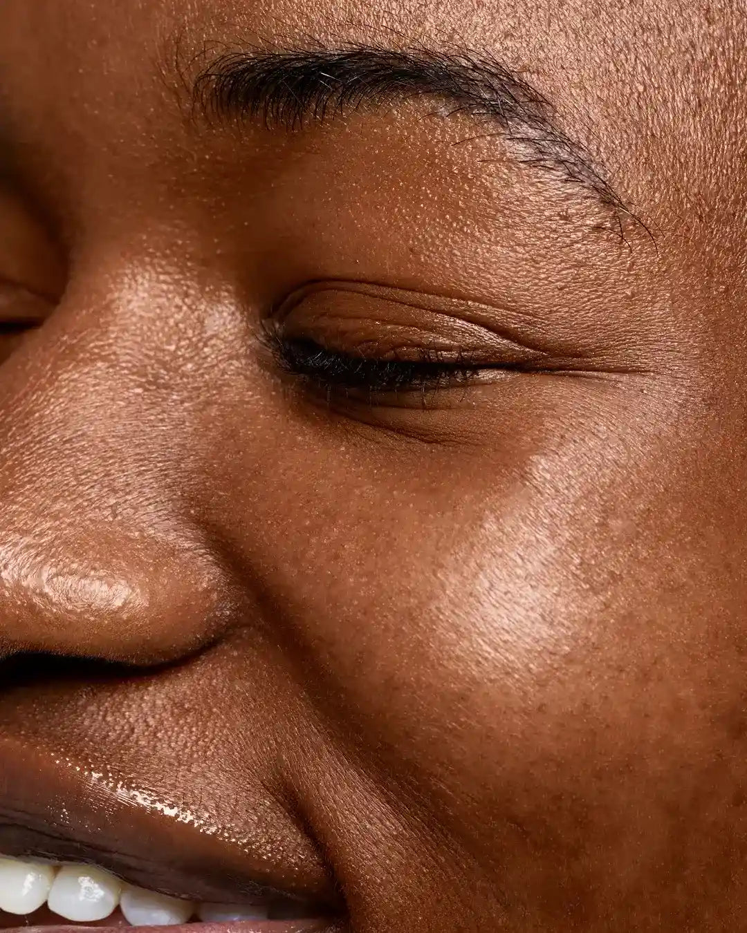 Proyección de pómulos