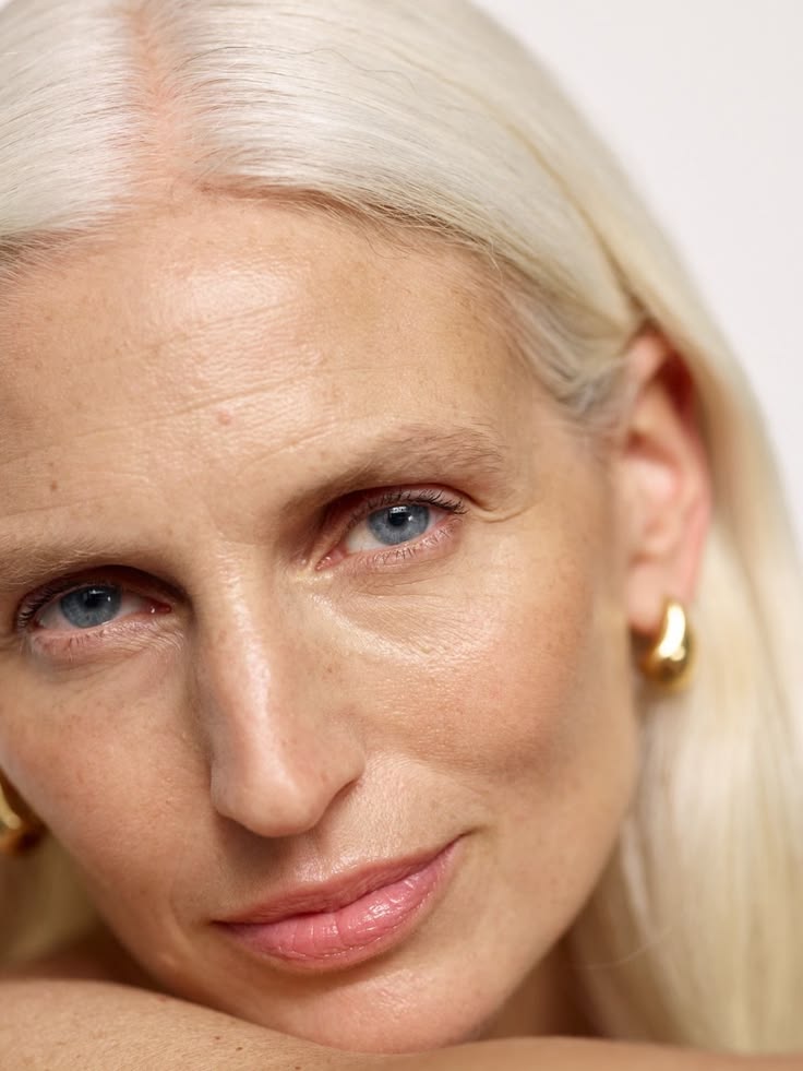 Peeling químico profundo