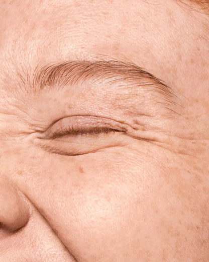 expression wrinkles