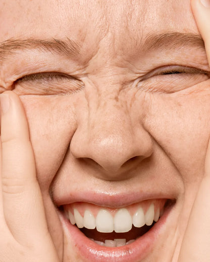 Baby expression wrinkles