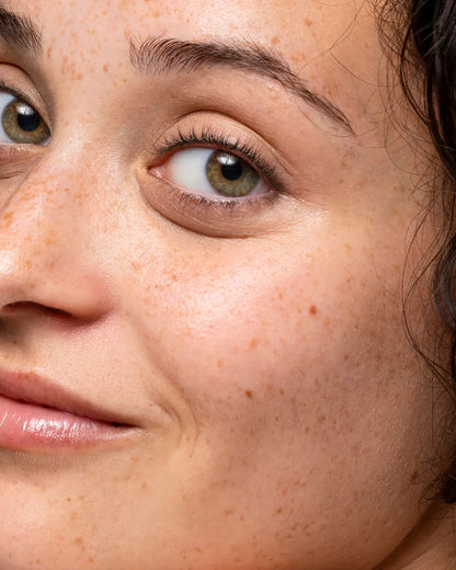 Facial Mesotherapy