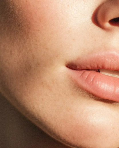 Skinbooster