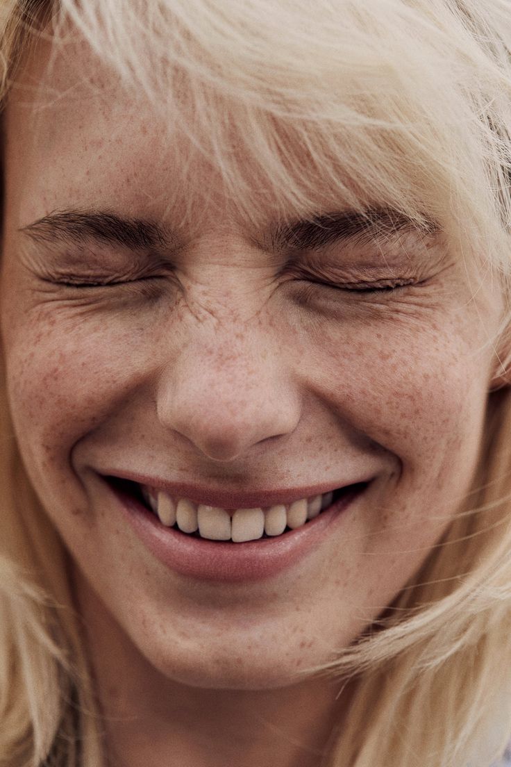 Relleno surco nasogeniano