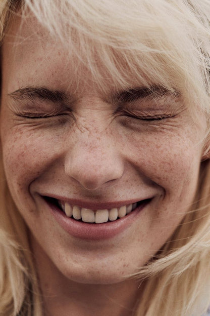 Relleno surco nasogeniano